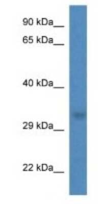 Western Blot: THG1L Antibody [NBP1-74219]