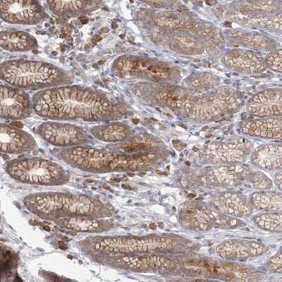 Immunohistochemistry-Paraffin: THNSL1 Antibody [NBP1-82130]