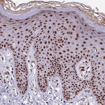 Immunohistochemistry-Paraffin: THOC2 Antibody [NBP1-92500]