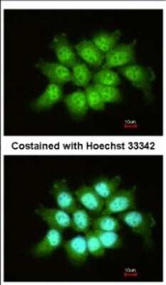 Immunocytochemistry/ Immunofluorescence: THOC7 Antibody [NBP2-20622]