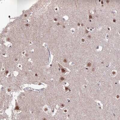 Immunohistochemistry-Paraffin: THOC7 Antibody [NBP1-82076]