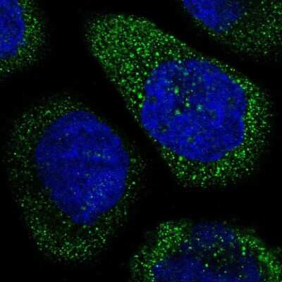 Immunocytochemistry/ Immunofluorescence: THSD1 Antibody [NBP1-86930]