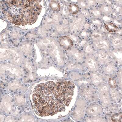 Immunohistochemistry-Paraffin: THSD7A Antibody (CL3779) [NBP2-61639]