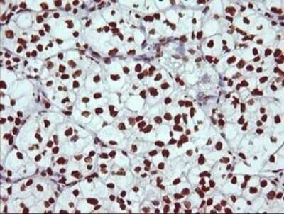 Immunohistochemistry: THUMPD1 Antibody (OTI1H6) - Azide and BSA Free [NBP2-74512]