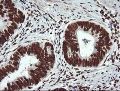 Immunohistochemistry: THUMPD1 Antibody (OTI1H6) - Azide and BSA Free [NBP2-74512]