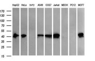 Western Blot: THUMPD1 Antibody (OTI1H6)Azide and BSA Free [NBP2-74512]