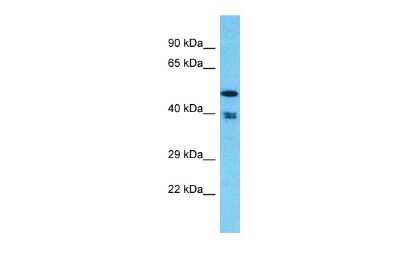 Western Blot: THUMPD1 Antibody [NBP2-88434]