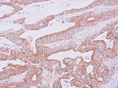 Immunohistochemistry-Paraffin: THUMPD2 Antibody [NBP2-20625]