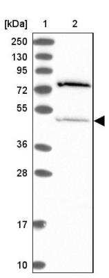 Western Blot: THUMPD2 Antibody [NBP1-92504]