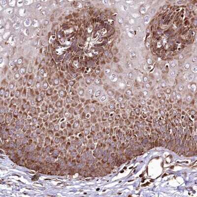 Immunohistochemistry-Paraffin: THUMPD3 Antibody [NBP2-38287]
