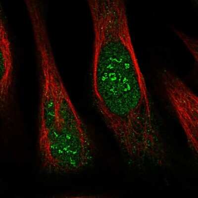 Immunocytochemistry/ Immunofluorescence: THYN1 Antibody [NBP1-86942]