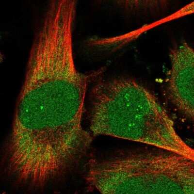 Immunocytochemistry/ Immunofluorescence: THYN1 Antibody [NBP2-32645]