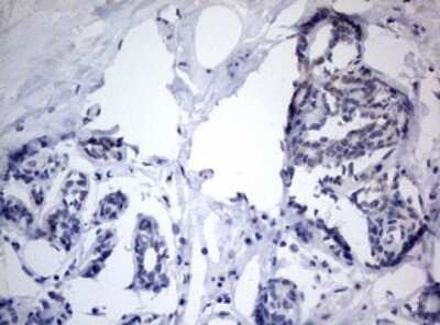 Immunohistochemistry: TIA1 Antibody (OTI1D7) [NBP2-46132]