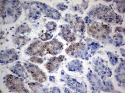 Immunohistochemistry: TIA1 Antibody (OTI1D7) [NBP2-46132]