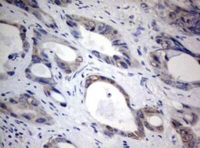 Immunohistochemistry: TIA1 Antibody (OTI1D7) [NBP2-46132]