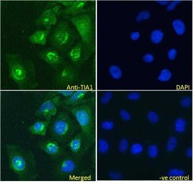 Immunocytochemistry/ Immunofluorescence: TIA1 Antibody [NB100-60555]