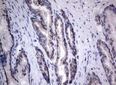 Immunohistochemistry: TIA1 Antibody (OTI1D7) - Azide and BSA Free [NBP2-74513]