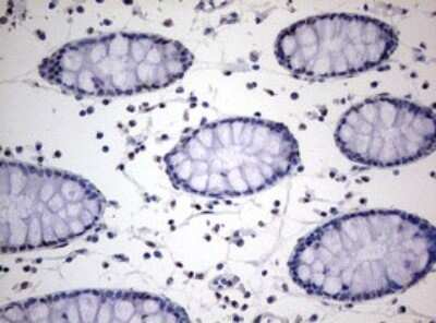 Immunohistochemistry: TIA1 Antibody (OTI1D7) - Azide and BSA Free [NBP2-74513]