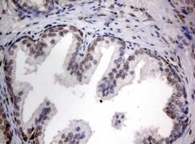 Immunohistochemistry: TIA1 Antibody (OTI1D7) - Azide and BSA Free [NBP2-74513]