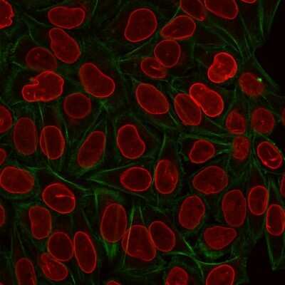 Immunocytochemistry/ Immunofluorescence: TIA1 Antibody (TIA1/1313) - BSA Free [NBP2-54406]