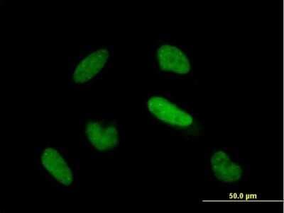 Immunocytochemistry/ Immunofluorescence: TIAL1 Antibody [H00007073-B01P]