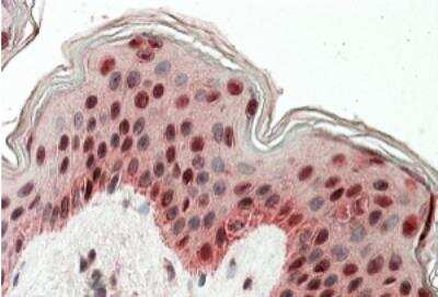 Immunohistochemistry-Paraffin: TIAL1 Antibody [NBP1-49832]
