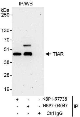 Immunoprecipitation: TIAL1 Antibody [NBP2-04047]