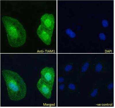 Immunocytochemistry/ Immunofluorescence: TIAM1 Antibody [NBP2-75096]
