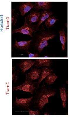 Immunocytochemistry/ Immunofluorescence: TIAM1 Antibody [NBP2-75096]