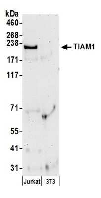 Western Blot: TIAM1 Antibody [NB100-2301]