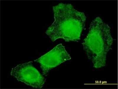 Immunocytochemistry/ Immunofluorescence: TIAM2 Antibody (3C1) [H00026230-M01]
