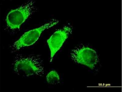 Immunocytochemistry/ Immunofluorescence: TID1 Antibody [H00009093-B01P]