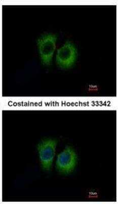 Immunocytochemistry/ Immunofluorescence: TID1 Antibody [NBP1-33387]