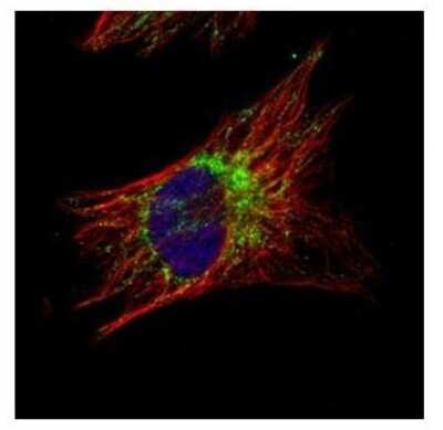 Immunocytochemistry/ Immunofluorescence: TID1 Antibody [NBP2-20633]