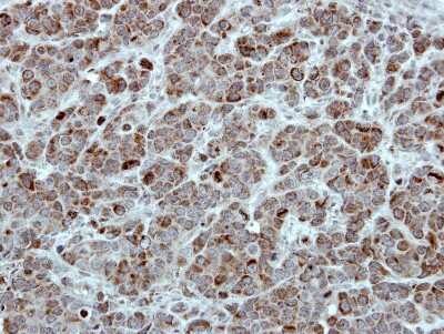 Immunohistochemistry-Paraffin: TID1 Antibody [NBP1-33387]