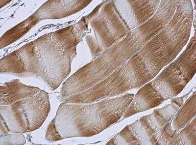 Immunohistochemistry-Paraffin: TID1 Antibody [NBP1-33387]