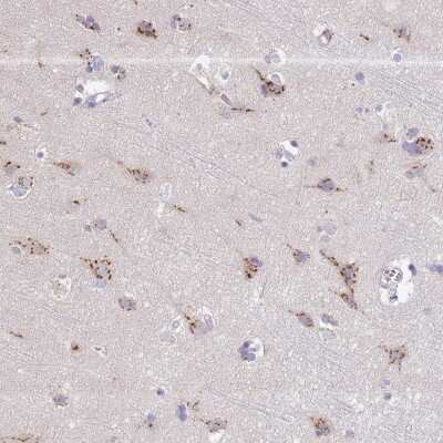 Immunohistochemistry-Paraffin: TID1 Antibody [NBP2-33416]