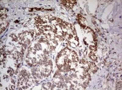 Immunohistochemistry: TIF1 alpha Antibody (OTI2D9) [NBP2-46213]