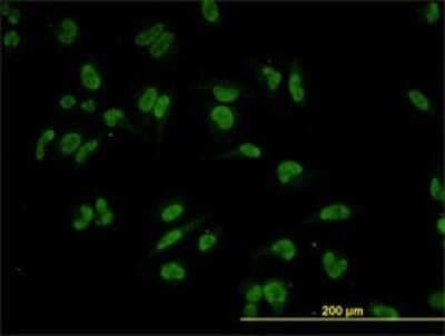 Immunocytochemistry/ Immunofluorescence: TIF1 alpha Antibody (2F2) [H00008805-M01]