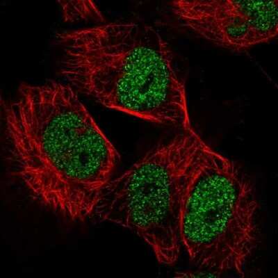 Immunocytochemistry/ Immunofluorescence: TIF1 alpha Antibody [NBP1-92506]