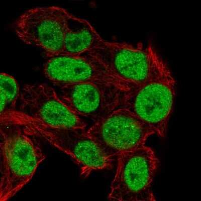 Immunocytochemistry/ Immunofluorescence: TIF1 alpha Antibody [NBP2-56418]