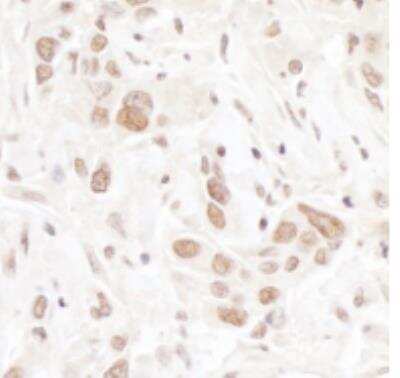 Immunohistochemistry-Paraffin: TIF1 alpha Antibody [NB100-2596]