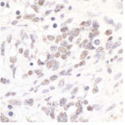 Immunohistochemistry-Paraffin: TIF1 alpha Antibody [NB100-2596]