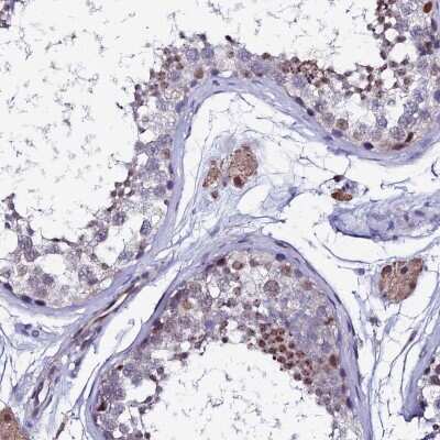 Immunohistochemistry-Paraffin: TIF1 alpha Antibody [NBP1-92506]