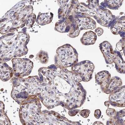 Immunohistochemistry-Paraffin: TIF1 alpha Antibody [NBP1-92506]