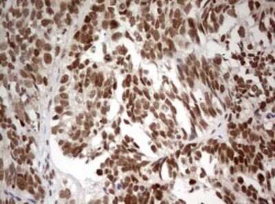 Immunohistochemistry: TIF1 alpha Antibody (OTI2D9) - Azide and BSA Free [NBP2-74514]