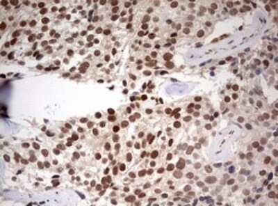 Immunohistochemistry: TIF1 alpha Antibody (OTI2D9) - Azide and BSA Free [NBP2-74514]