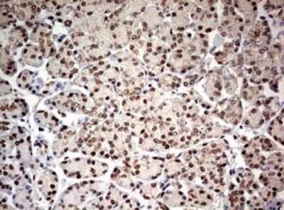 Immunohistochemistry: TIF1 alpha Antibody (OTI2D9) - Azide and BSA Free [NBP2-74514]