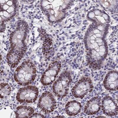 Immunohistochemistry-Paraffin: TIF1 alpha Antibody [NBP1-92506]