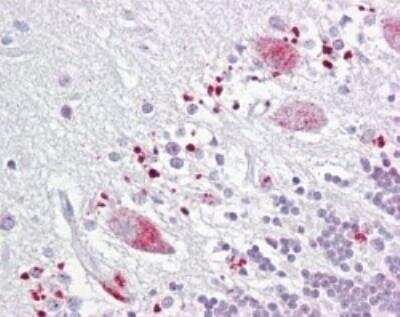 Immunohistochemistry-Paraffin: TIGAR/C12orf5 Antibody [NBP2-24754]